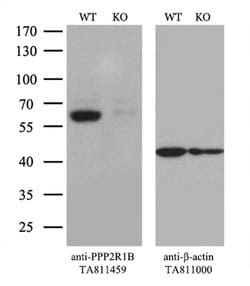 PPP2R1B Monoclonal Antibody (OTI8C5), TrueMAB , OriGene:Antibodies:Primary