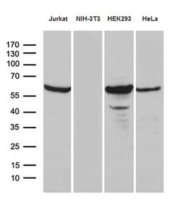 PPP2R1B Monoclonal Antibody (OTI8C5), TrueMAB , OriGene 30 &mu;L; Unconjugated:Antibodies,