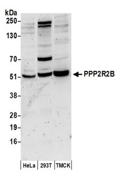 PPP2R2B Rabbit anti-Human, Mouse, Polyclonal, Bethyl Laboratories 100 &mu;L;
