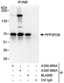 PPP2R3B Rabbit anti-Human, Polyclonal, Bethyl Laboratories 10 &mu;L; Unconjugated:Antibodies,
