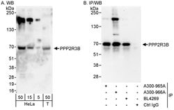 PPP2R3B Rabbit anti-Human, Polyclonal, Bethyl Laboratories 100 &mu;l; Unlabeled:Antibodies,