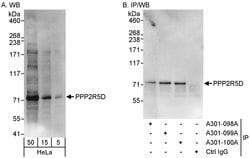 PPP2R5D Rabbit anti-Human, Polyclonal, Bethyl Laboratories 100 &mu;L; Unconjugated:Antibodies,