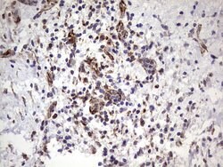 PPP2R5D Monoclonal Antibody (OTI3B3), TrueMAB , OriGene:Antibodies:Primary