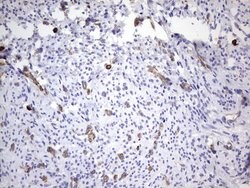 PPP2R5D Monoclonal Antibody (OTI3B3), TrueMAB , OriGene 100 &mu;L; Unconjugated:Antibodies,