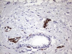 PPP2R5D Monoclonal Antibody (OTI3B3), TrueMAB , OriGene 100 &mu;L; Unconjugated:Antibodies,