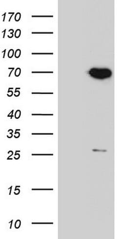 PPP2R5D Monoclonal Antibody (OTI3B3), TrueMAB , OriGene 100 &mu;L; Unconjugated:Antibodies,