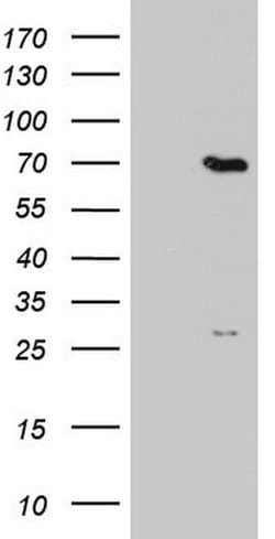 PPP2R5D Monoclonal Antibody (OTI2F2), TrueMAB , OriGene 100 &mu;L; Unconjugated:Antibodies,