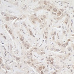 PPP3CA Rabbit anti-Human, Mouse, Polyclonal, Bethyl Laboratories 100 &mu;L;