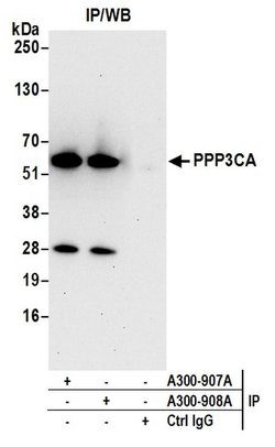 PPP3CA Rabbit anti-Human, Mouse, Polyclonal, Bethyl Laboratories 100 &mu;L;