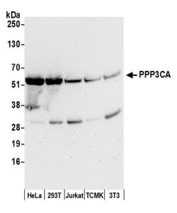 PPP3CA Polyclonal Antibody, Bethyl Laboratories:Antibodies:Primary Antibodies