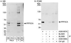 PPP3CA Rabbit anti-Human, Mouse, Polyclonal, Bethyl Laboratories 100 &mu;L;