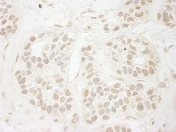 PPP3CA Polyclonal Antibody, Bethyl Laboratories 10 &mu;l; Unlabeled:Antibodies,