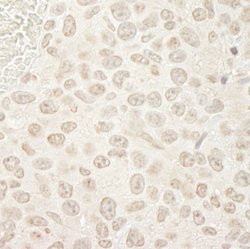PPP3CA Polyclonal Antibody, Bethyl Laboratories 10 &mu;l; Unlabeled:Antibodies,