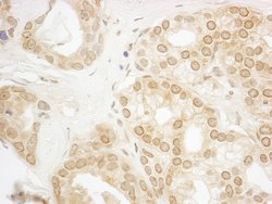 PPP3CA Polyclonal Antibody, Bethyl Laboratories 10 &mu;l; Unlabeled:Antibodies,