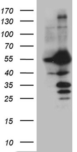 PPP3CB Monoclonal Antibody (OTI2E4), TrueMAB , OriGene 100 &mu;L; Unconjugated:Antibodies,
