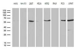 PPP3CB Monoclonal Antibody (OTI2E4), TrueMAB , OriGene 100 &mu;L; Unconjugated:Antibodies,