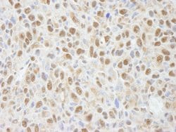 PPP4C Polyclonal Antibody, Bethyl Laboratories 10 &mu;L; Unconjugated:Antibodies,