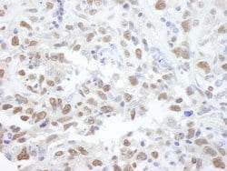 PPP4C Polyclonal Antibody, Bethyl Laboratories 10 &mu;L; Unconjugated:Antibodies,