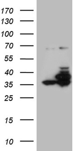 PPP4C Monoclonal Antibody (OTI2H8), TrueMAB , OriGene 30 &mu;L; Unconjugated:Antibodies,