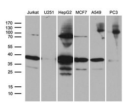 PPP4C Monoclonal Antibody (OTI2H8), TrueMAB , OriGene 30 &mu;L; Unconjugated:Antibodies,