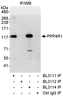 PPP4R1 Rabbit anti-Human, Polyclonal, Bethyl Laboratories 100 &mu;L; Unconjugated:Antibodies,