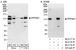 PPP4R1 Rabbit anti-Human, Mouse, Polyclonal, Bethyl Laboratories 100 &mu;L;