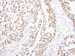 PPP4R2 Rabbit anti-Human, Mouse, Polyclonal, Bethyl Laboratories 10 &mu;L;