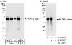 PPP4R3 Alpha Rabbit anti-Human, Polyclonal, Bethyl Laboratories 100 &mu;L;