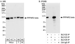 PPP4R3 Beta Rabbit anti-Human, Mouse, Polyclonal, Bethyl Laboratories 100
