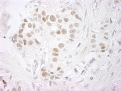 PPP4R3 Beta Polyclonal Antibody, Bethyl Laboratories:Antibodies:Primary