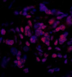 PPP4R3 Beta Polyclonal Antibody, Bethyl Laboratories 10 &mu;L; Unconjugated:Antibodies,