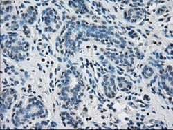 PPP5C Mouse anti-Canine, Human, Clone: OTI2G2, lyophilized, TrueMAB 100