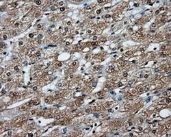 PPP5C Mouse anti-Human, Clone: OTI4E1, liquid, TrueMAB 100 &mu;L; Unconjugated:Antibodies,