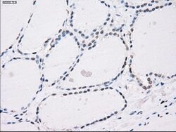 PPP5C Mouse anti-Canine, Human, Clone: OTI4G8, lyophilized, TrueMAB 100