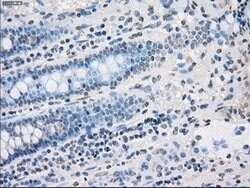 PPP5C Mouse anti-Canine, Human, Clone: OTI4G8, lyophilized, TrueMAB 100