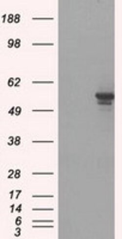 PPP5C Mouse anti-Canine, Human, Clone: OTI4G8, lyophilized, TrueMAB 100