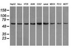 PPP5C Mouse anti-Canine, Human, Rat, Clone: OTI5A8, lyophilized, TrueMAB
