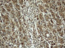 PPT1 Mouse anti-Human, Clone: OTI1F10, TrueMAB , Origene 30 &mu;L; Unconjugated:Antibodies