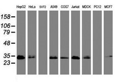 PPT1 Mouse anti-Canine, Human, Clone: OTI1A10, lyophilized, TrueMAB 100 &mu;g | Buy Online | OriGene | Fisher Scientific