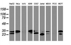 PPT1 Monoclonal Antibody (OTI1B10), TrueMAB , OriGene 100 &mu;L; Unconjugated:Antibodies,