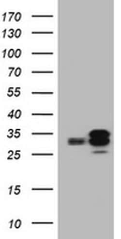 PPT1 Mouse anti-Human, Clone: OTI1F10, TrueMAB , Origene 30 &mu;L; Unconjugated:Antibodies