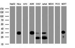 PPT1 Mouse anti-Human, Clone: OTI1F10, TrueMAB , Origene 30 &mu;L; Unconjugated:Antibodies