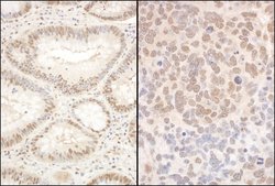 PQBP1 Rabbit anti-Human, Mouse, Polyclonal, Bethyl Laboratories 100 &mu;L;