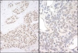 PQBP1 Rabbit anti-Human, Mouse, Polyclonal, Bethyl Laboratories 100 &mu;L;