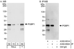 PQBP1 Rabbit anti-Human, Mouse, Polyclonal, Bethyl Laboratories 100 &mu;L;