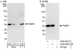 PQBP1 Rabbit anti-Human, Mouse, Polyclonal, Bethyl Laboratories 100 &mu;L;
