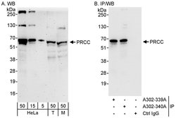 PRCC Rabbit anti-Human, Mouse, Polyclonal, Bethyl Laboratories 100 &mu;L;