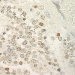 PRCC Polyclonal Antibody, Bethyl Laboratories 10 &mu;L; Unconjugated:Antibodies,