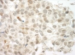 PRCC Polyclonal Antibody, Bethyl Laboratories:Antibodies:Primary Antibodies