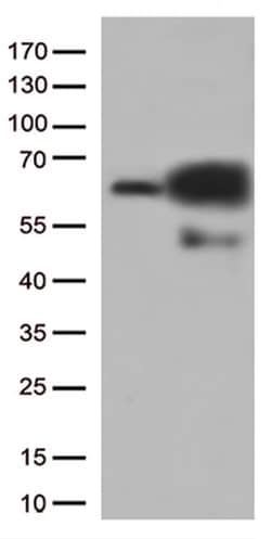 PRCC Monoclonal Antibody (OTI5H7), TrueMAB , OriGene:Antibodies:Primary
